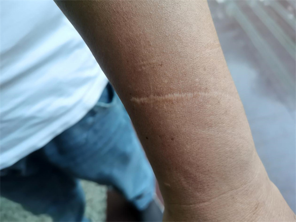 Pg电子平台：全国见义勇为英雄陈锋：后备箱里的“移动”生命线(图6)